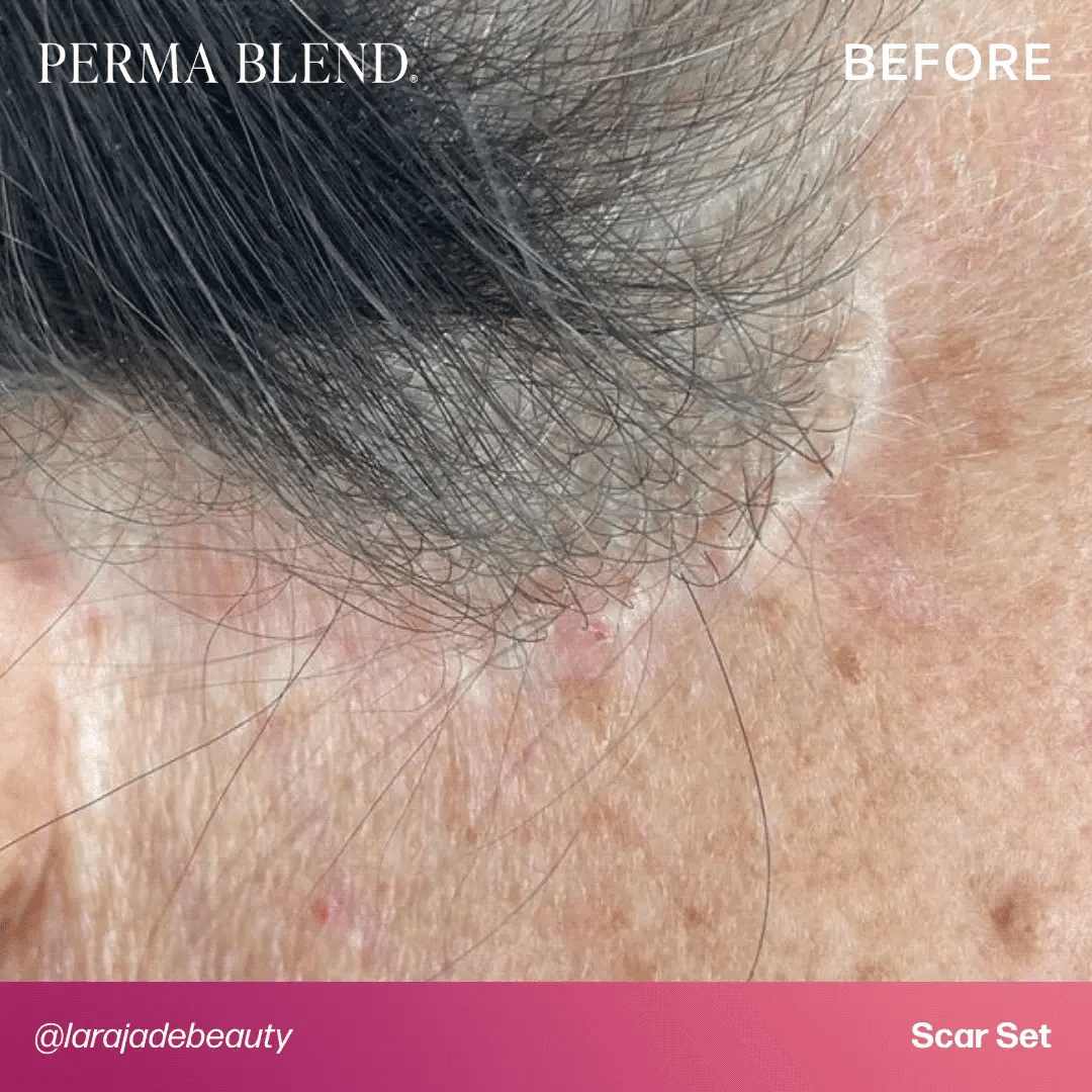 Mandy Sauler - Scar Set