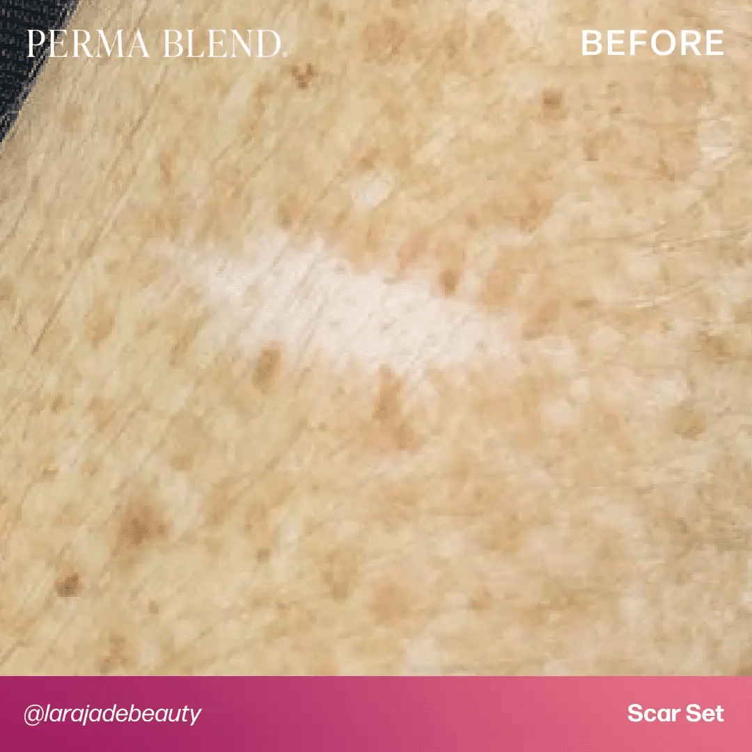 Mandy Sauler - Scar Set